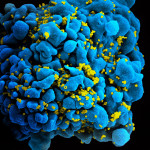HIV infected T cell by NIAID on Flickr