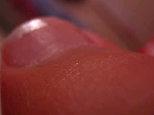 Brighton hospital trust patient dies after having toe amputated