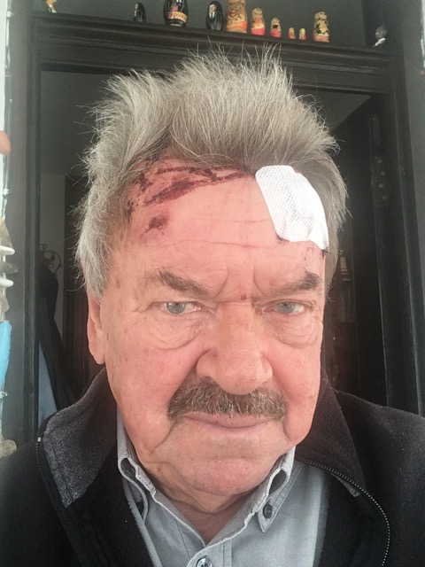 A Halloween horror made better by our NHS