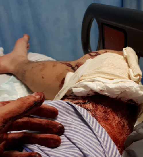 Brighton man stabbed