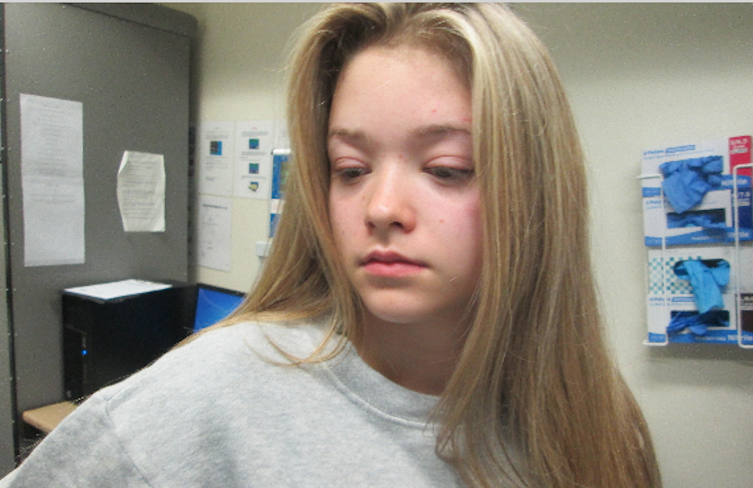 Police hunt girl, 18, over seafront bottle attack