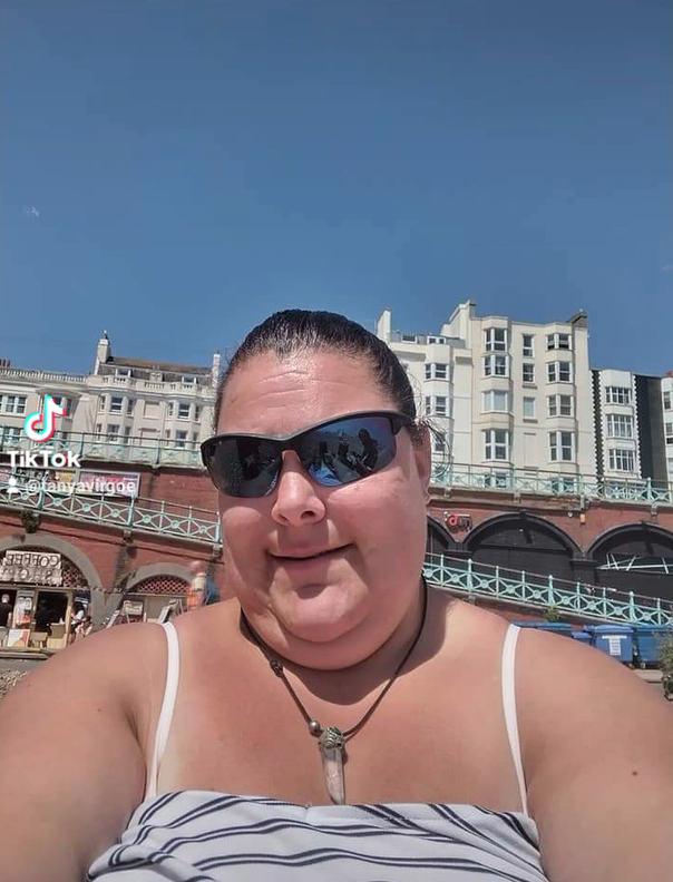 Disabled woman fights for accessible housing after accident on stairs