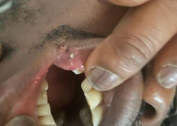 Co-op sacks worker who needed stitches after attack by shoplifter