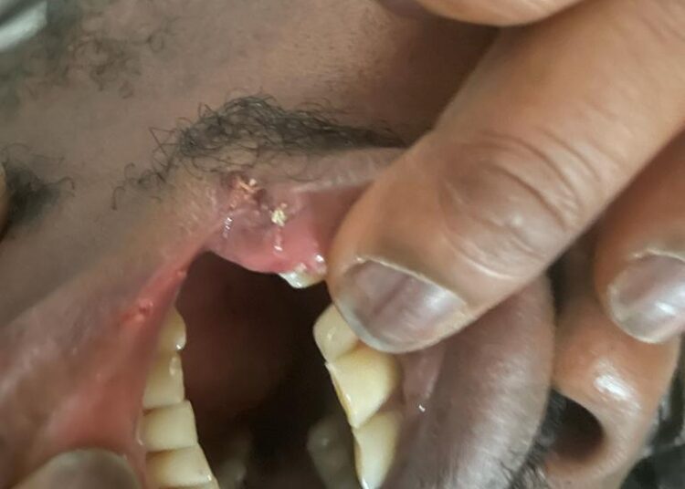 Co-op sacks worker who needed stitches after attack by shoplifter